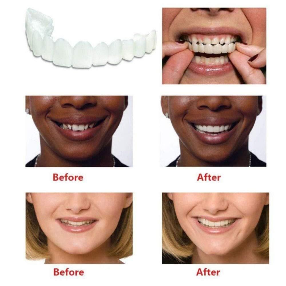 😍Instant and Confident on Smile Fit Flex Cosmetic Teeth Denture Teeth😍