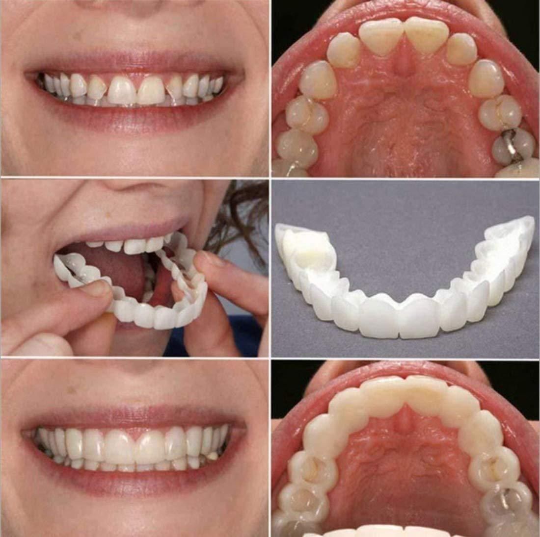 😍Instant and Confident on Smile Fit Flex Cosmetic Teeth Denture Teeth😍